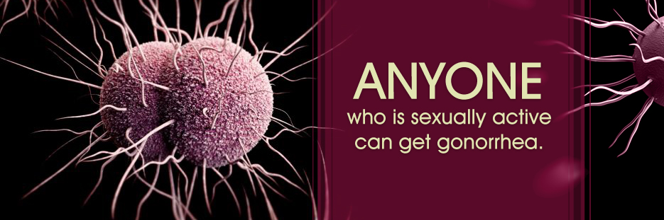  Can You Get Gonorrhea From Kissing Public Health