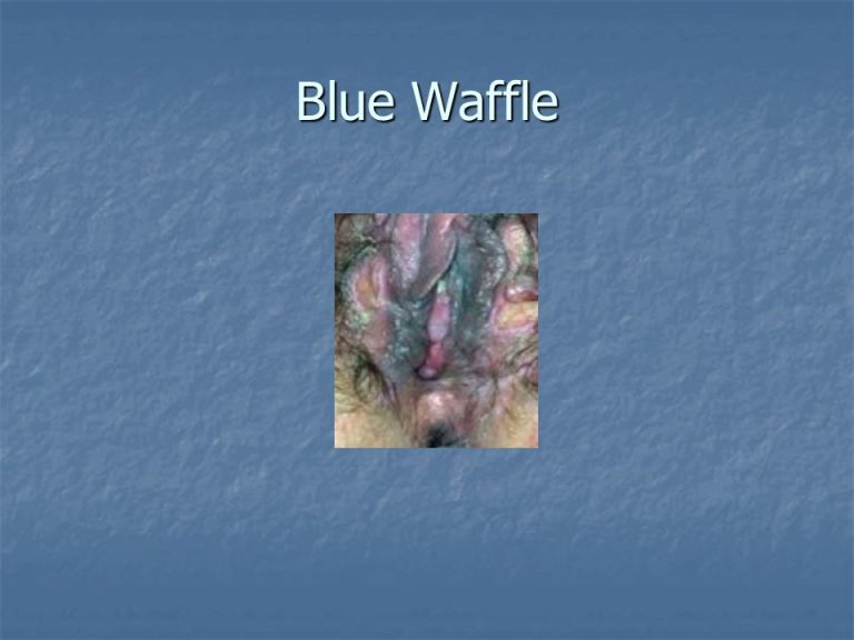 Blue Waffle Public Health 