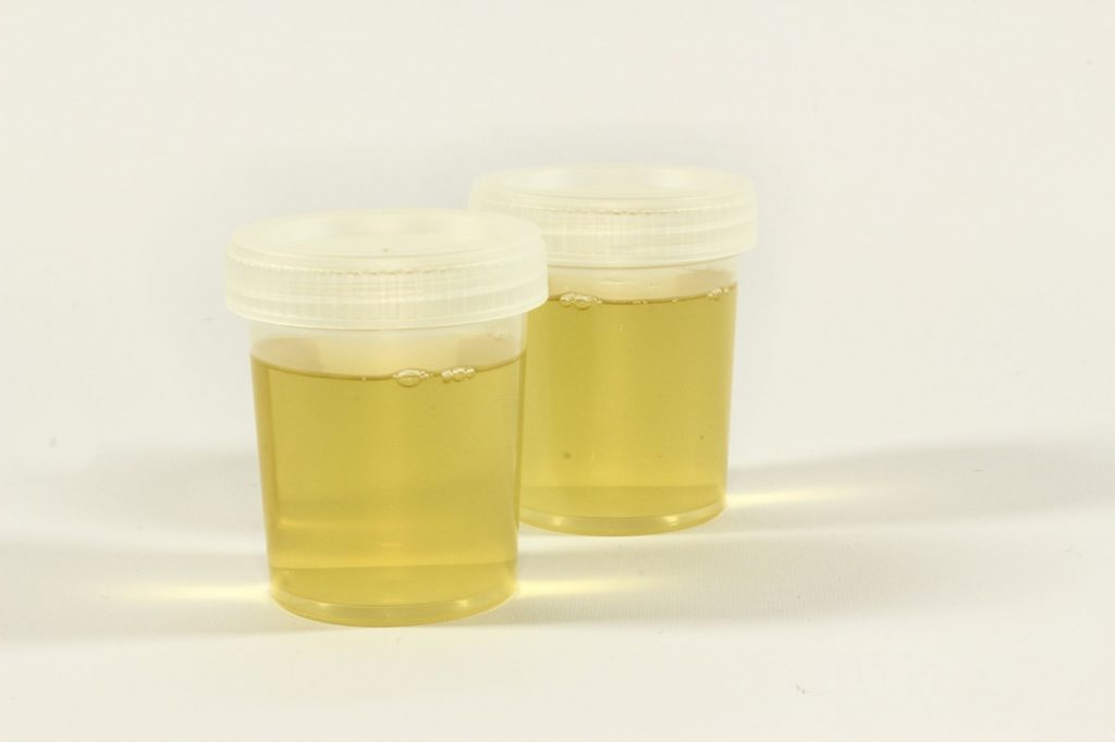 Can Labs Tell The Difference Between Real And Synthetic Urine? Public